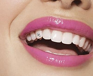 Tooth Gems